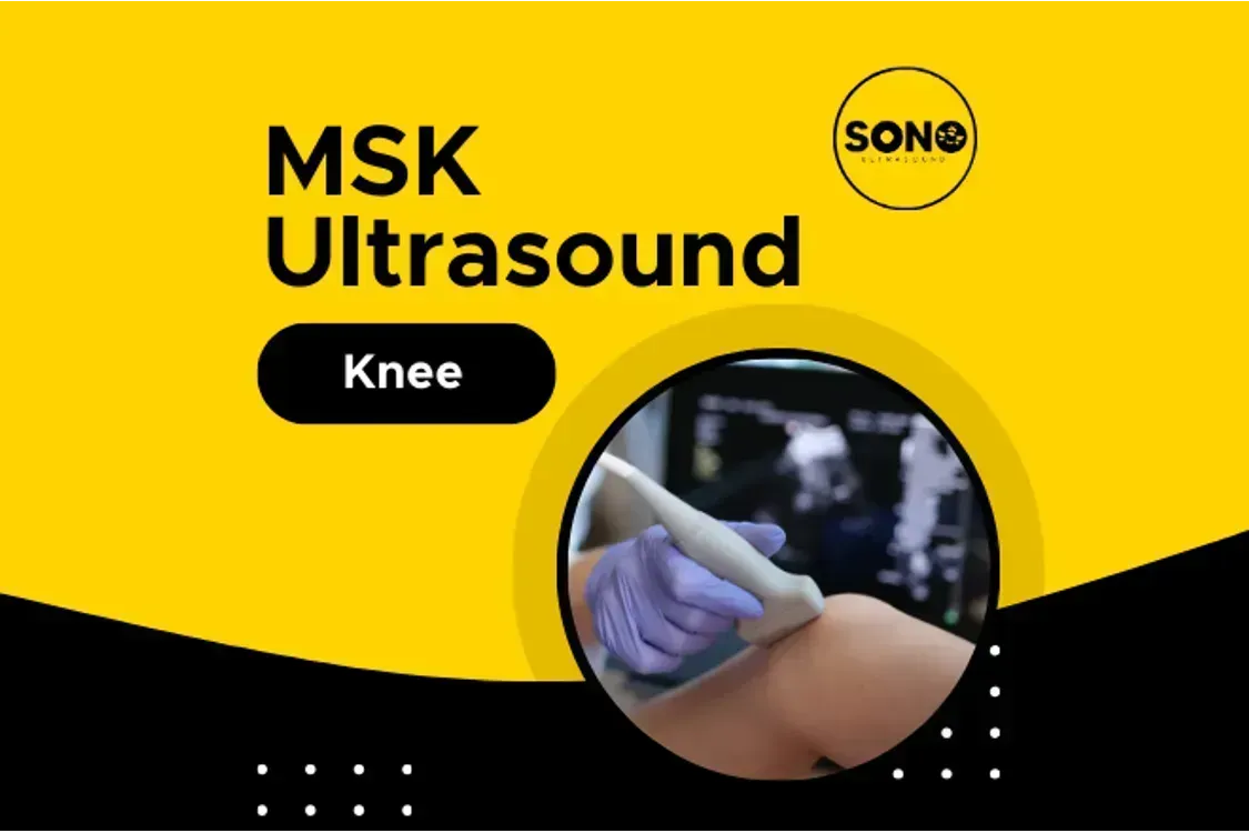 MSK Scan: Knee Malaysia